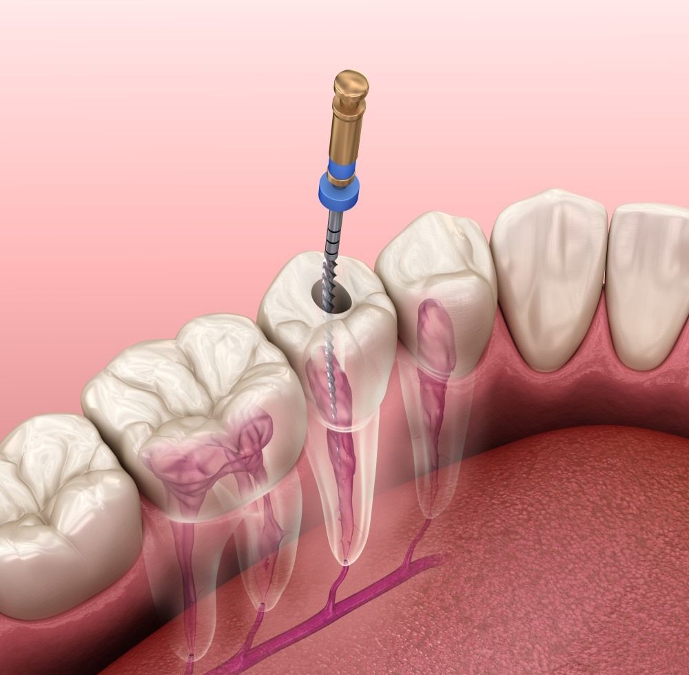 Endodoncja